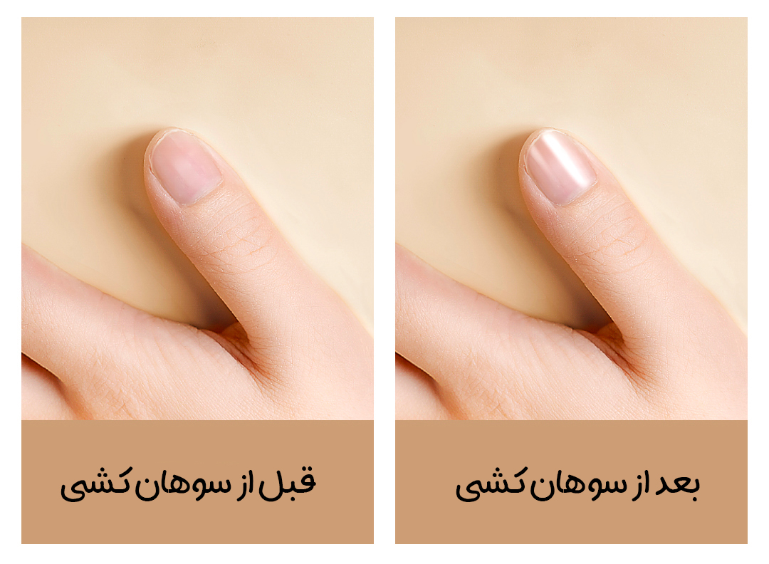 ناخن‌گیر برقی شیائومی Showlon مدل LQ-EDZJD01