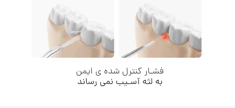 دستگاه شستشوی دهان و دندان 2 شیائومی Mijia مدل ME0705 دستگاه شستشوی دهان و دندان 2 شیائومی Mijia مدل ME0705