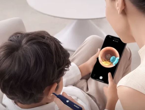 گوش پاک کن هوشمند شیائومی Bebird مدل plus I35R