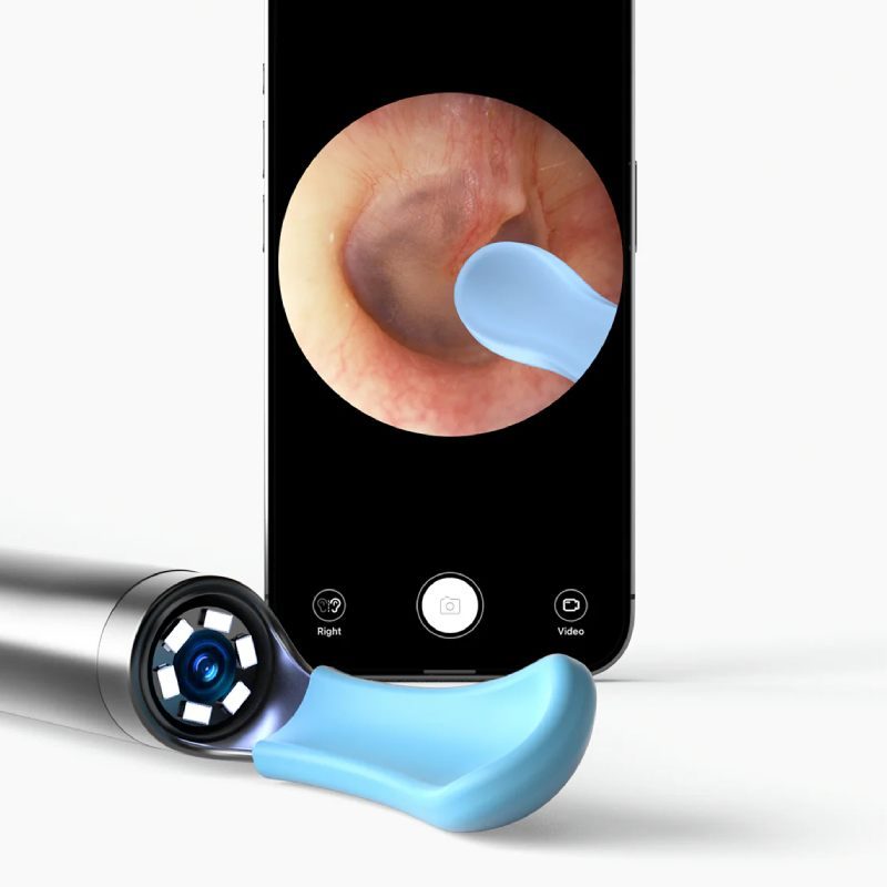 گوش پاک کن شیائومی Bebird مدل R1 Plus گوش پاک کن شیائومی Bebird مدل R1 Plus